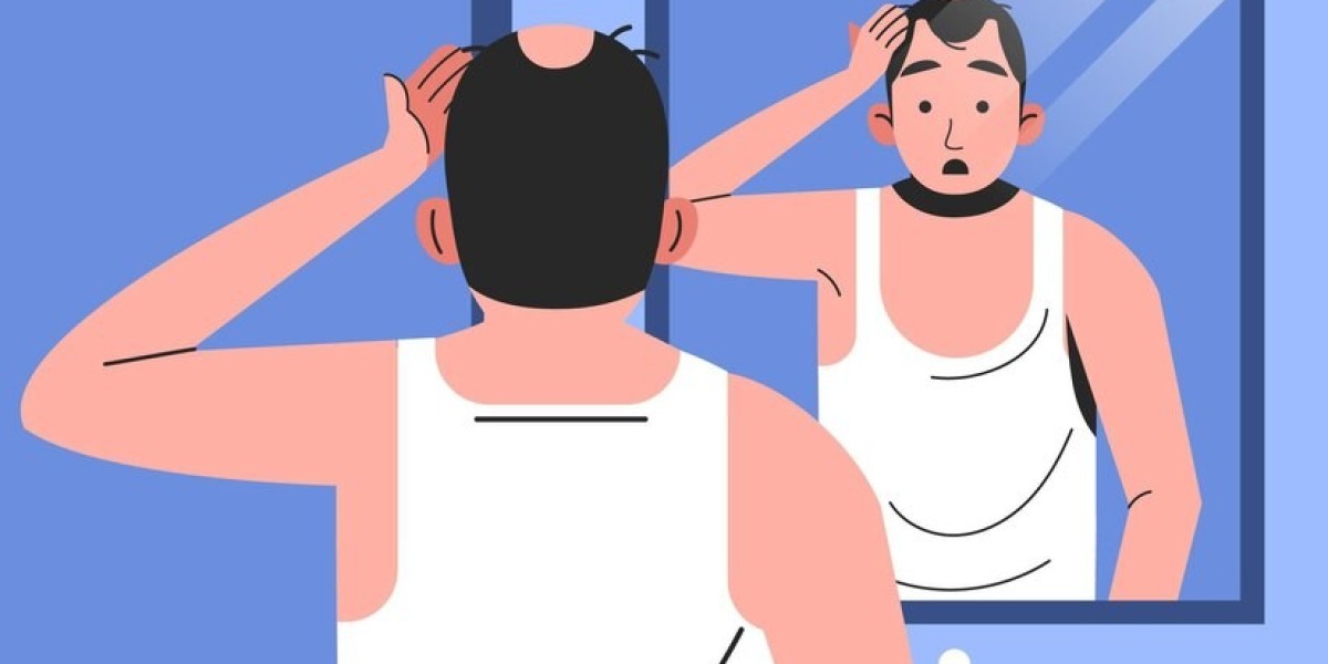 Is a Hair Transplant Right for You? Factors to Consider Before the Procedure