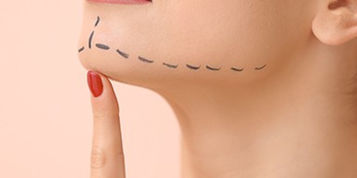 Jaw Surgery for Correcting Overbites: What to Know