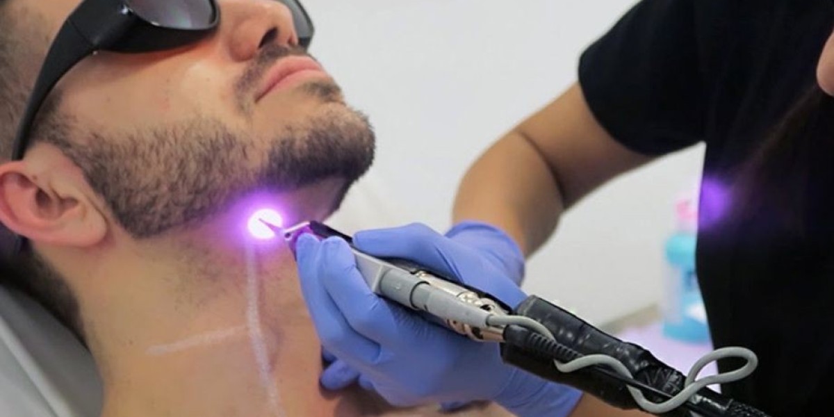 Are Laser Hair Removal Results in Riyadh Permanent?