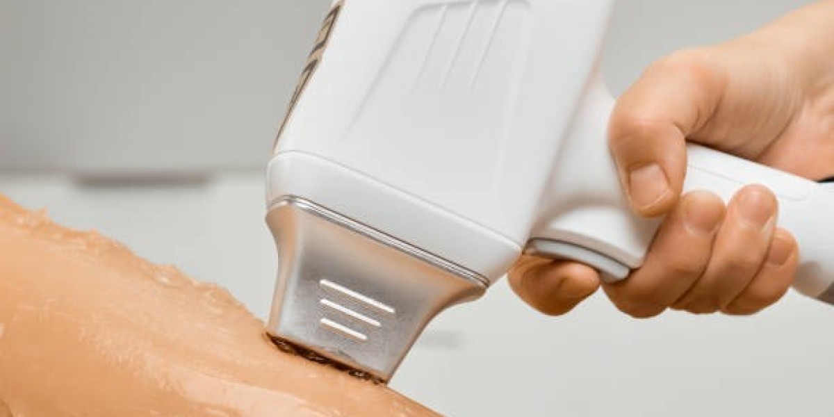 إزالة الشعر بالليزر في الرياض: دليل لأفضل الأسعار والعروض