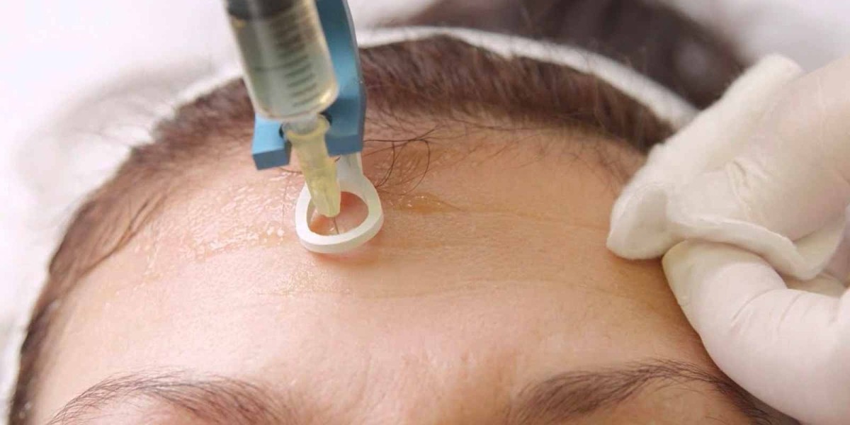 My Mesotherapy Journey: A Personal Account from a Dubai Resident