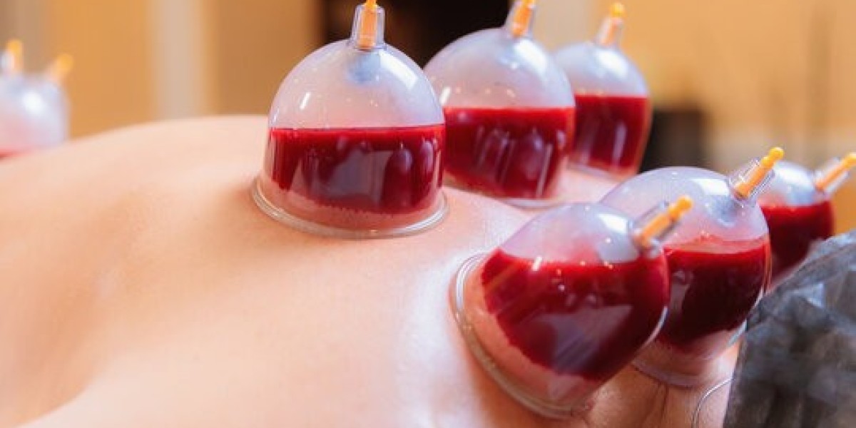 Rejuvenate Your Health: The Role of Hijama Cupping Therapy in Detoxification