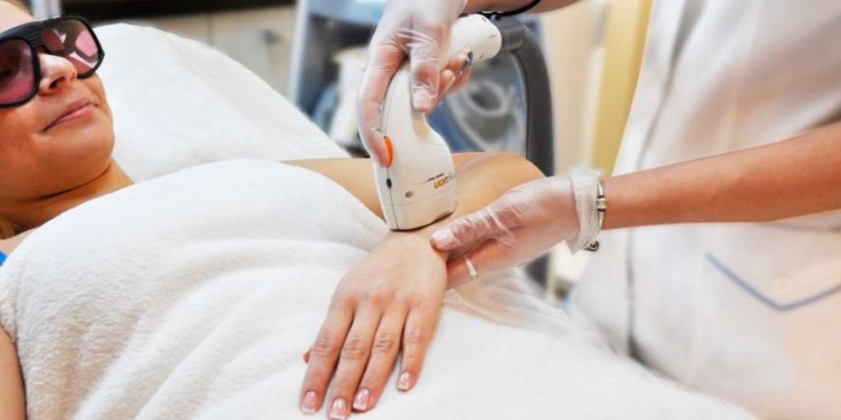 Laser Hair Removal for Sensitive Skin: Safety Tips