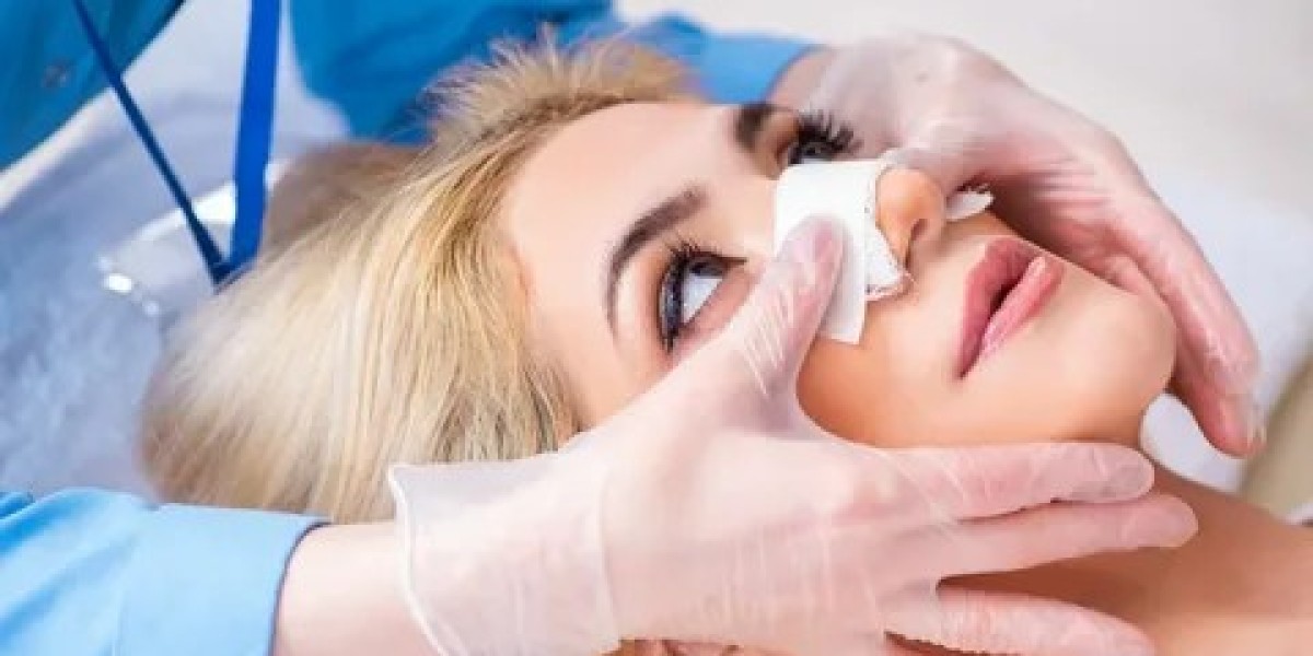 The Psychological Impact of Rhinoplasty: Real Stories from Patients