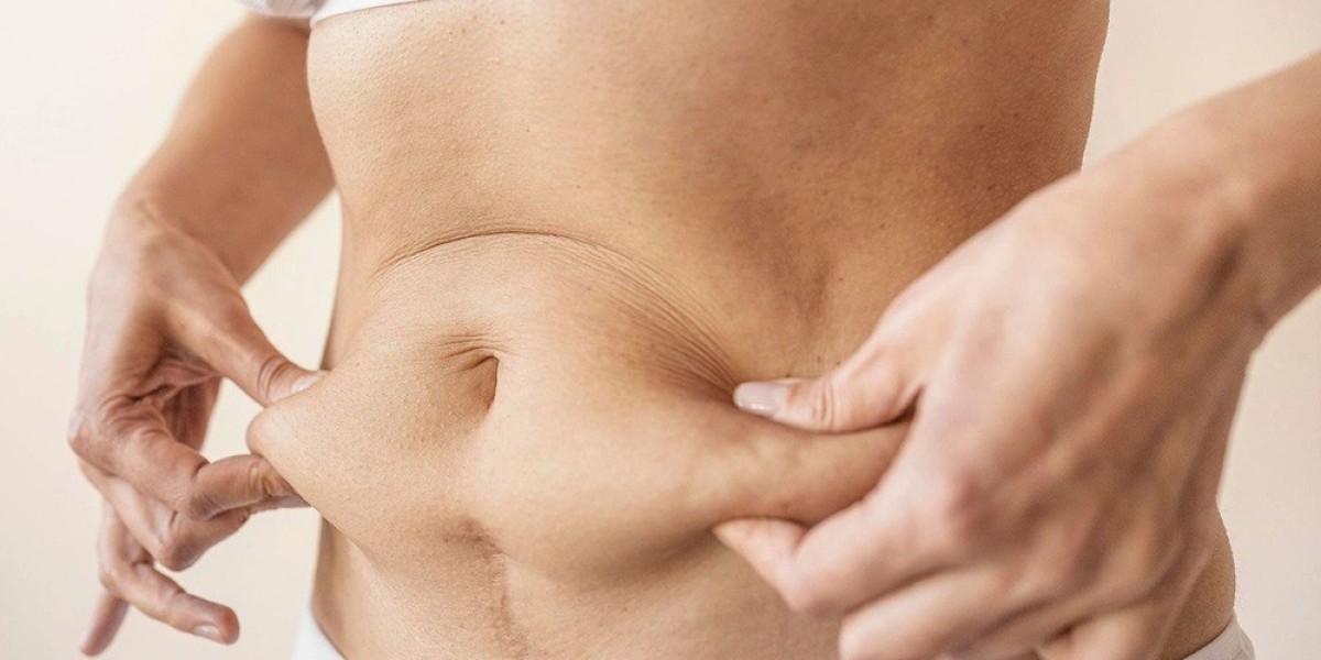 Lipo Abdominoplasty: The Key to a Confident You in Islamabad