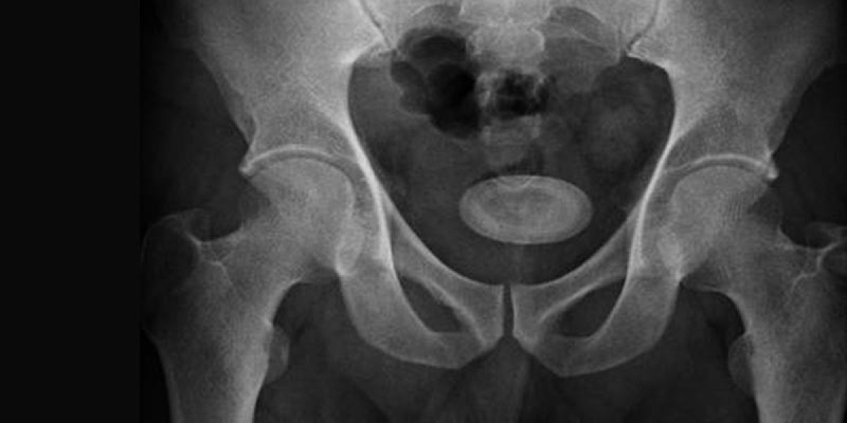 Prostate Treatment in Delhi
