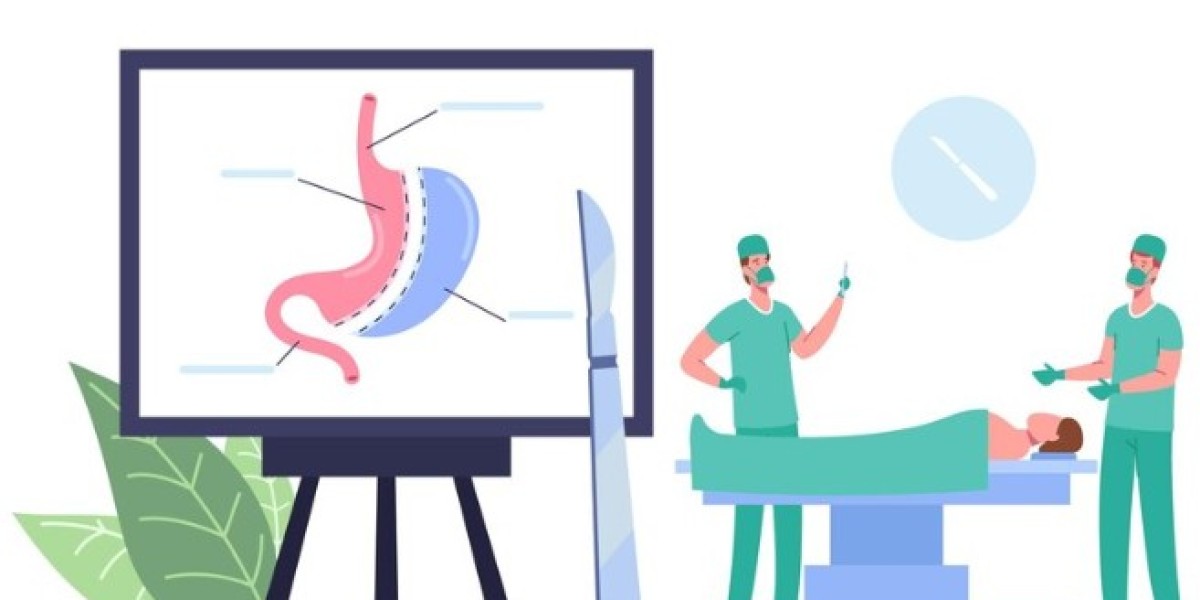 Common Questions About Gallbladder Removal Surgery