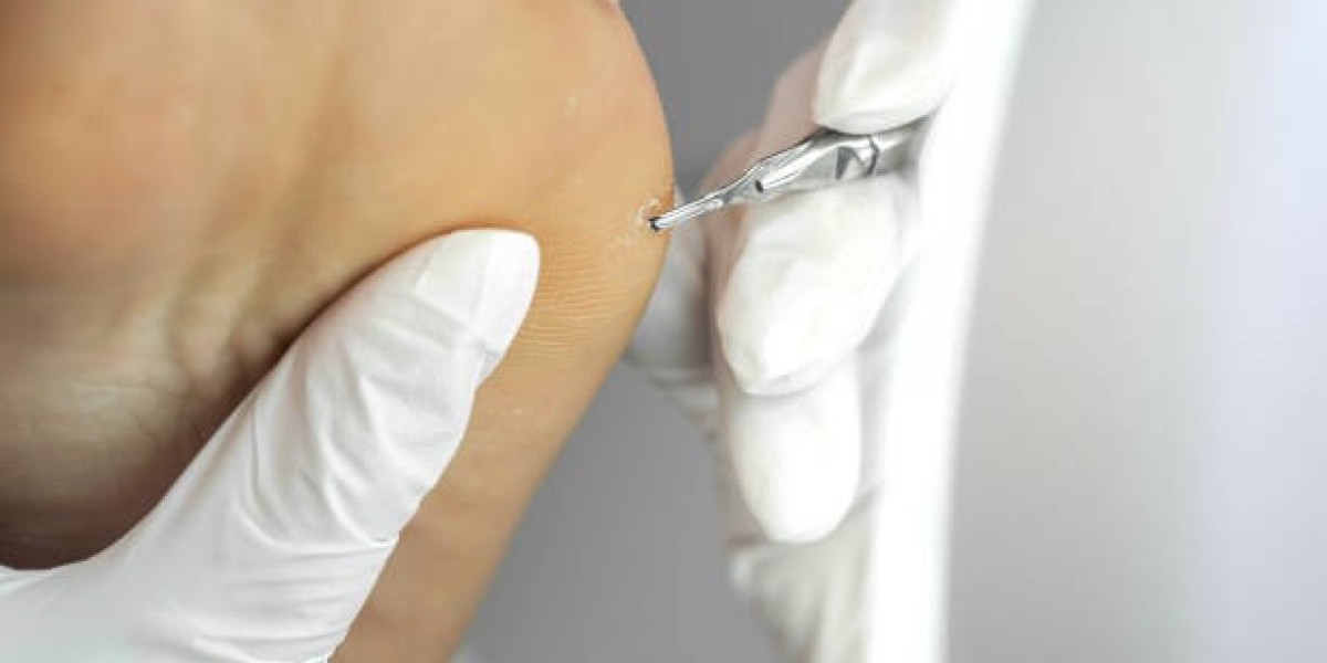Real Patients, Real Results: Cryosurgery – Cryotherapy in Riyadh