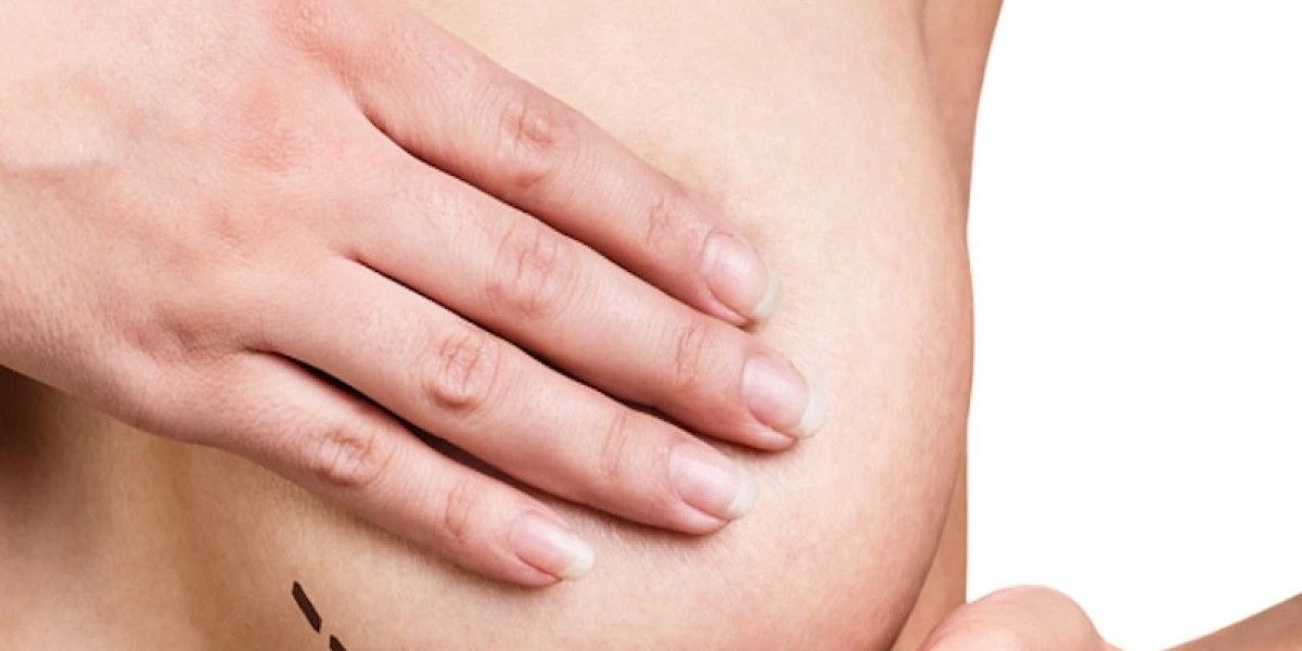 Exploring the Latest Innovations in Breast Lift Surgery in Dubai