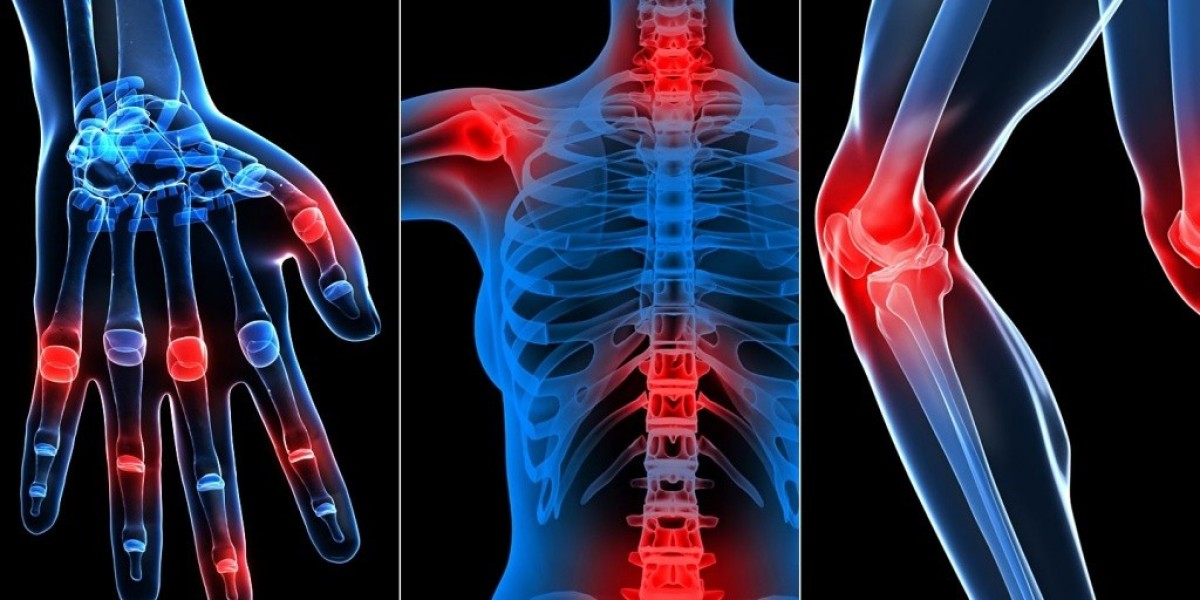 Arthritis Therapeutics Market: Analyzing the Surge in Treatment Demand