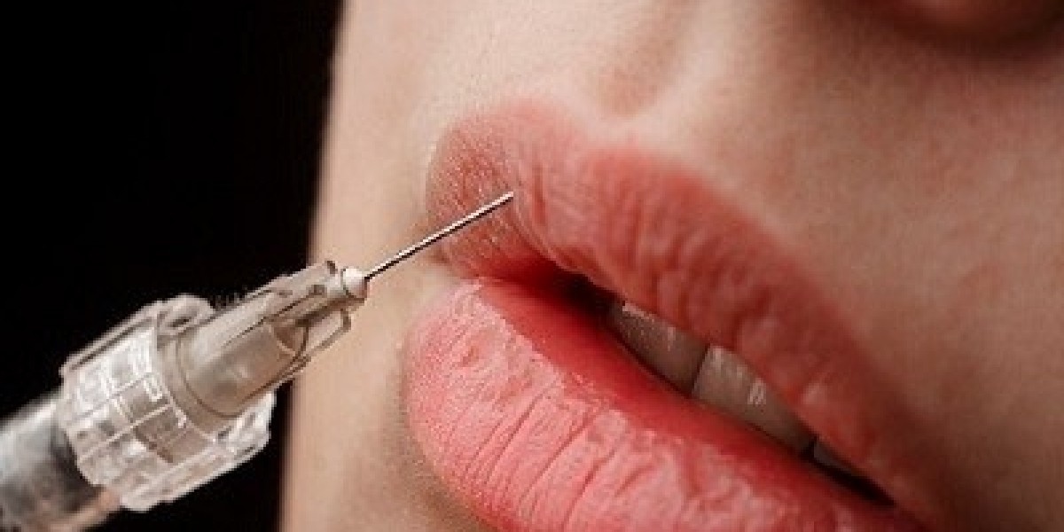 Boost Your Confidence with Lip Fillers in Islamabad