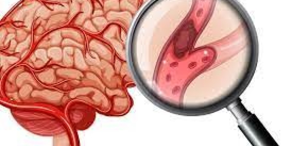 Endovascular Therapy Device Market Size, Scope And Forecast Report