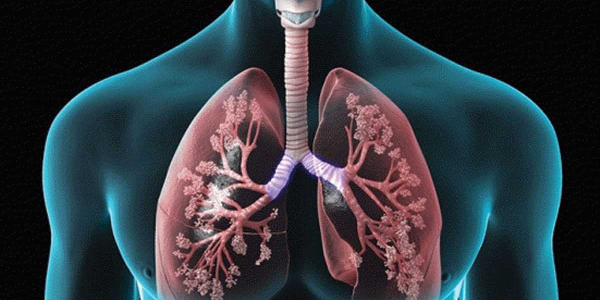 The Alpha 1 Lung Disease Market is driven by Growing Awareness Regarding Disease Management
