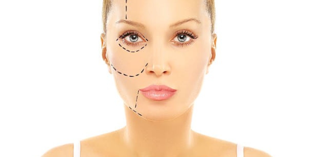 Eyelid Surgery in Riyadh: Achieve a Youthful Glow