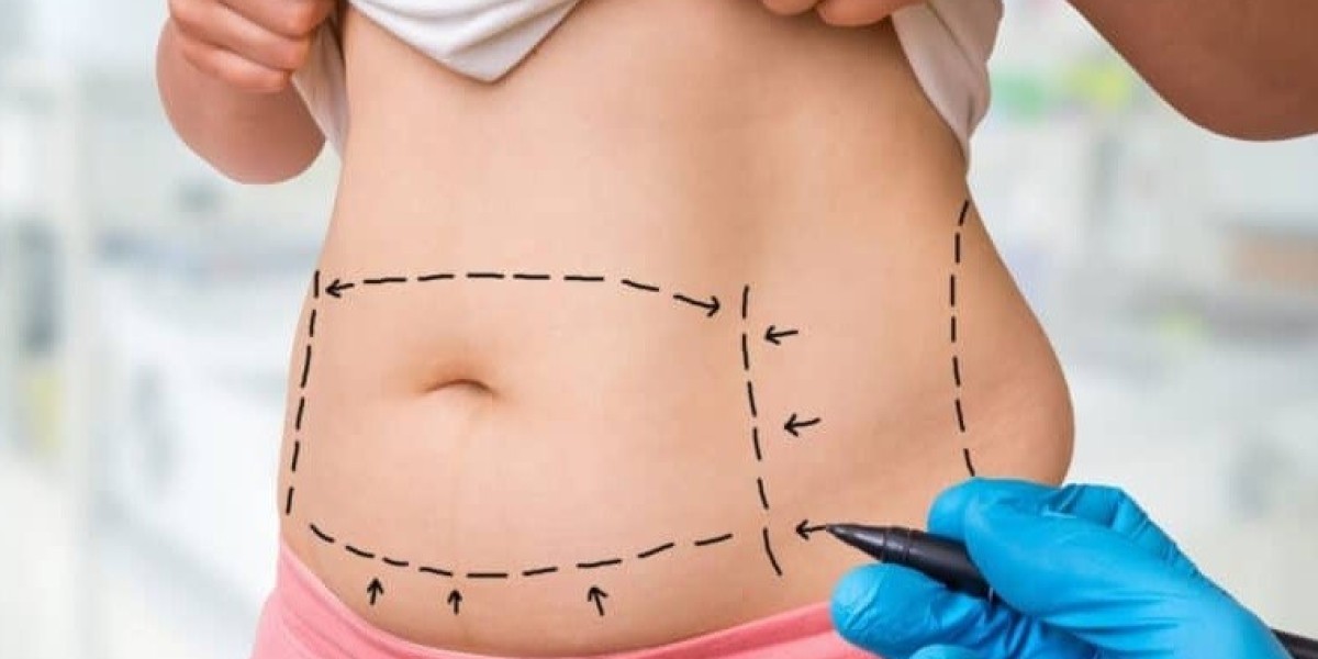 Tummy Tuck Cost vs. Other Cosmetic Procedures in Islamabad