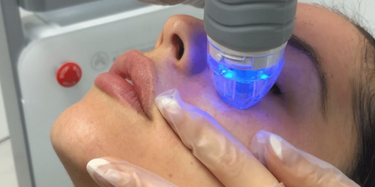 Fractional RF Microneedling: The Non-Surgical Skin Lift Option in Dubai