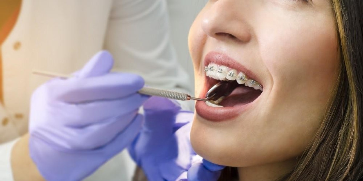 The Financial Aspects of Tooth Fillings: Costs in Dubai Explained