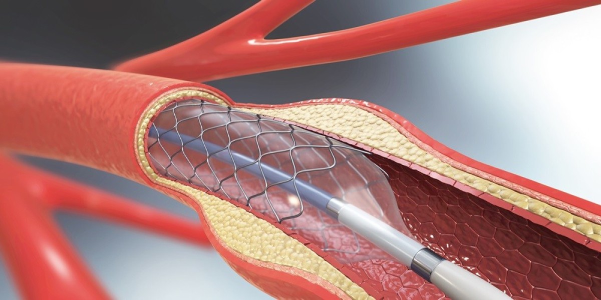 Angioplasty Balloons Market: Rising Prevalence of Cardiovascular Diseases Fuels Demand