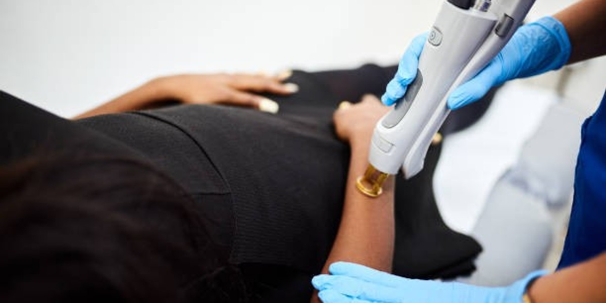 إزالة الشعر بالليزر في الرياض: الحل المثالي لبشرة ناعمة