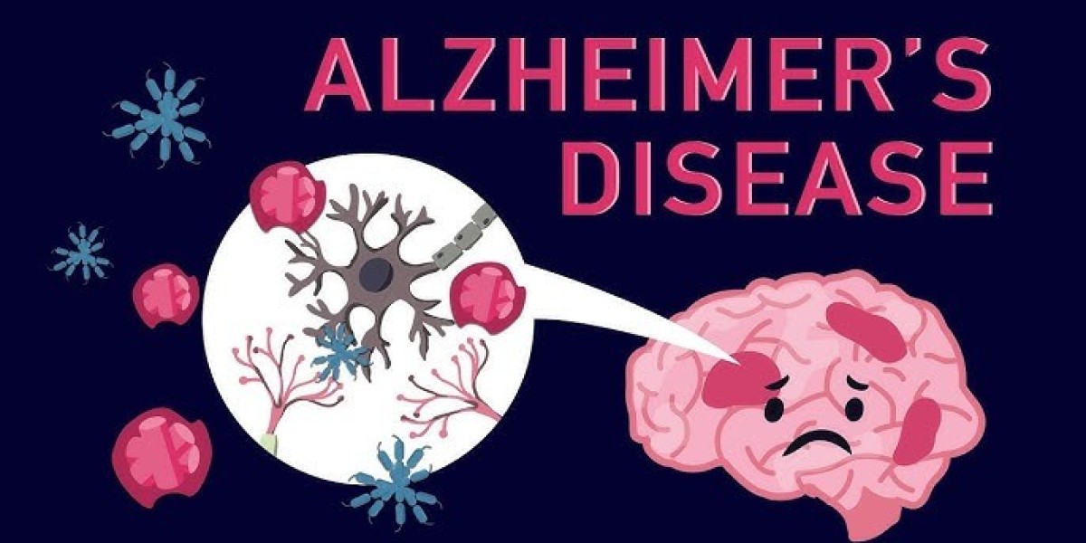 Alzheimer’s Disease: Exploring the Latest Treatment Options for Better Care