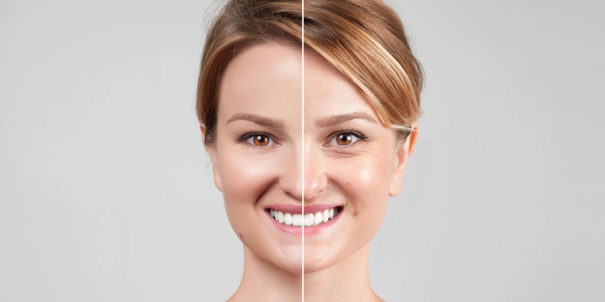 Does the number of sessions affect the overall cost of Fractional CO2 laser treatment in Dubai