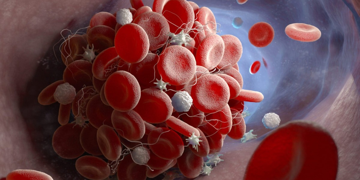 Disseminated Intravascular Coagulation Treatment Market Forecast and Analysis by 2032