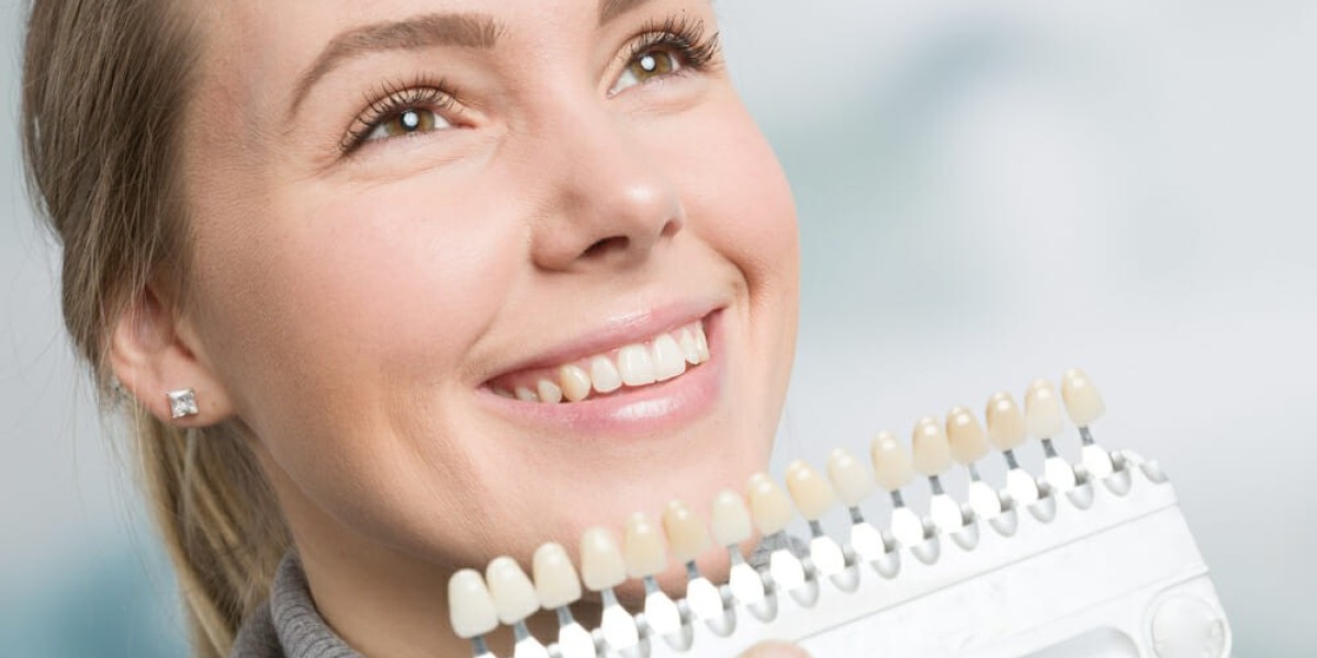 A Guide to Dental Veneers: Achieving the Perfect Smile in Dubai