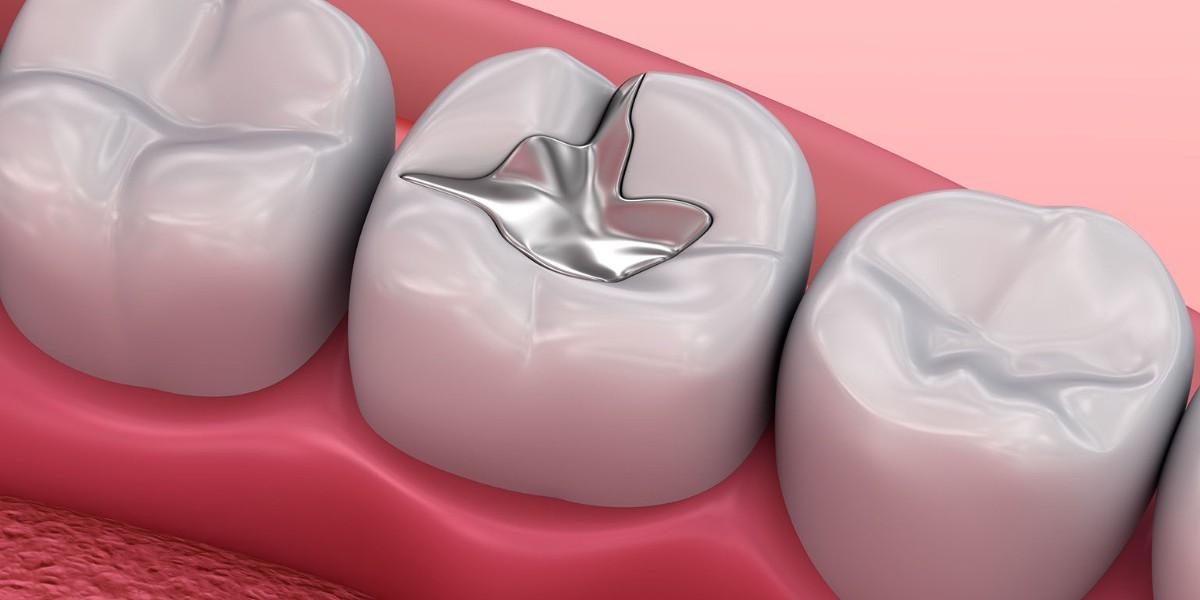 Tooth Filling Materials Market: Innovations in Restorative Dentistry and Their Influence on Market Trends