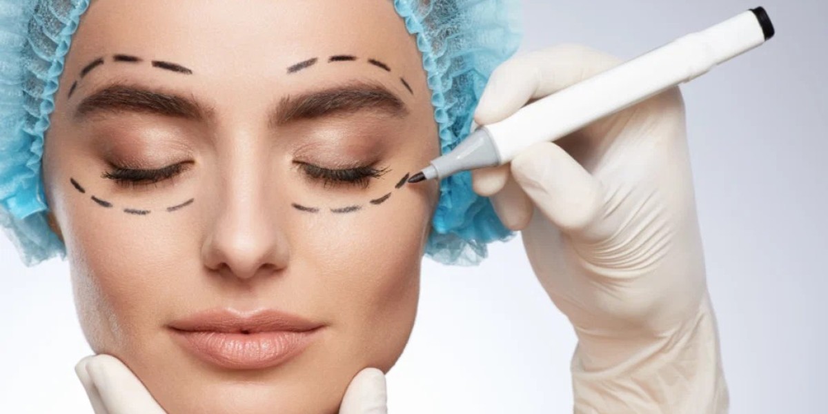Transform Your Look with Eyelid Surgery in Islamabad