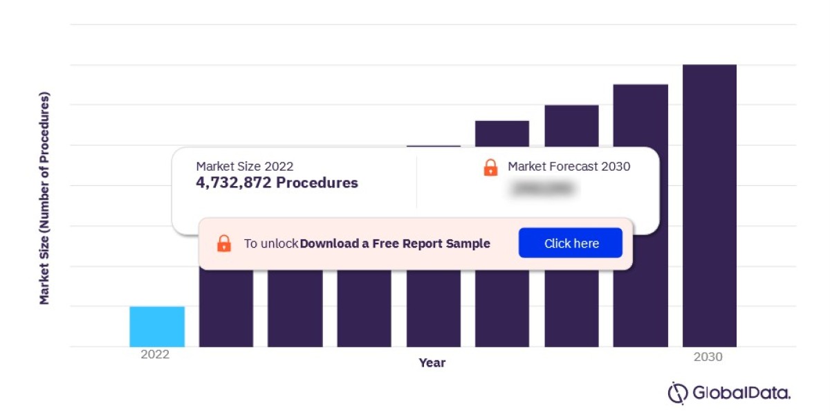 Key Players in the US Central Venous Catheters Procedures Market: Competitive Analysis and Market Share