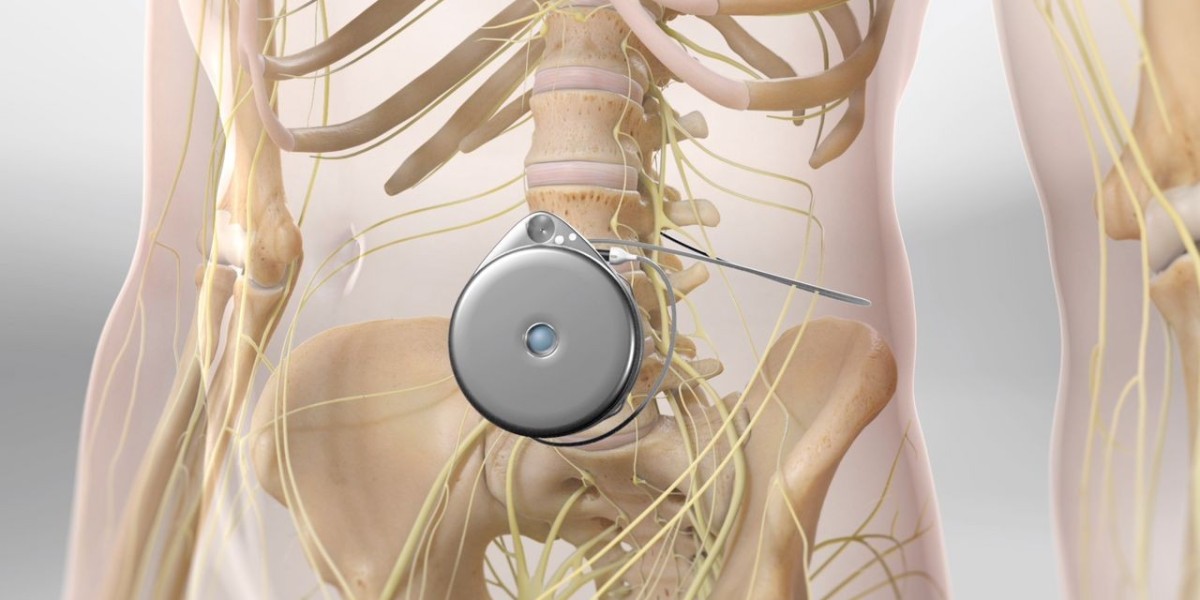 Intrathecal Therapy Market Emerging Trends, Size, Demands by 2032