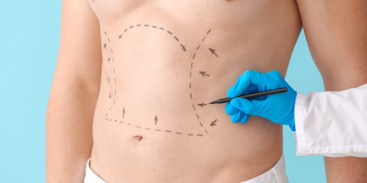 Recovery Tips After Liposuction in Riyadh