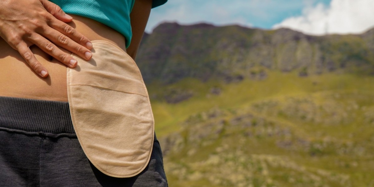 Ostomy Devices Market: How Awareness and Support Networks Are Driving Adoption