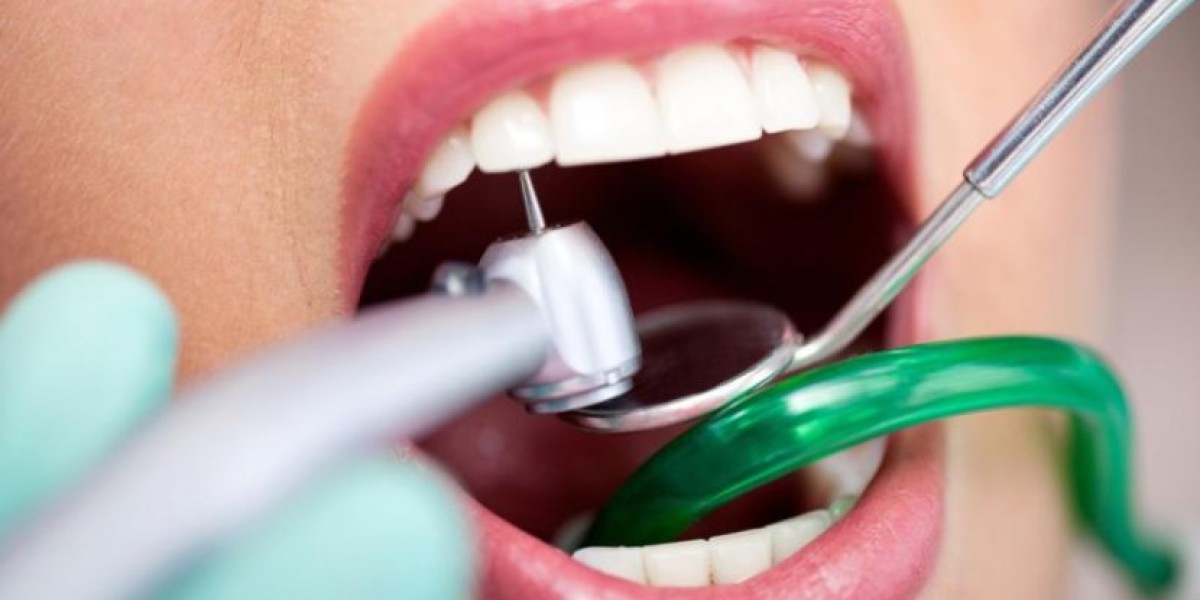Global Dental Consumables Market Trends, Share, Size, Outlook & Forecast | 2024 - 2032