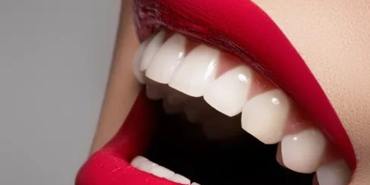 Boost Your Confidence with a Hollywood Smile Transformation