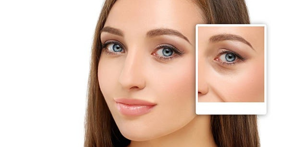 Achieve Your Dream Shape: Liposuction in Riyadh