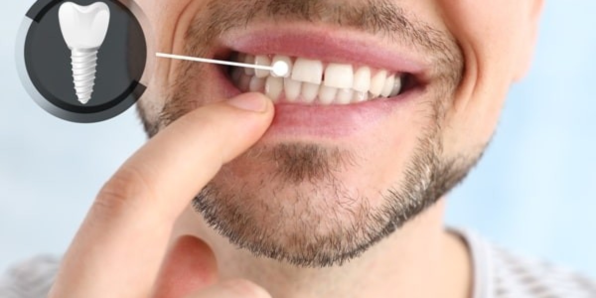 How Long Does It Take to Recover After a Dental Implant?