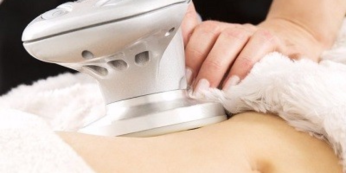 The Benefits of Choosing Laser Liposuction Over Traditional Methods