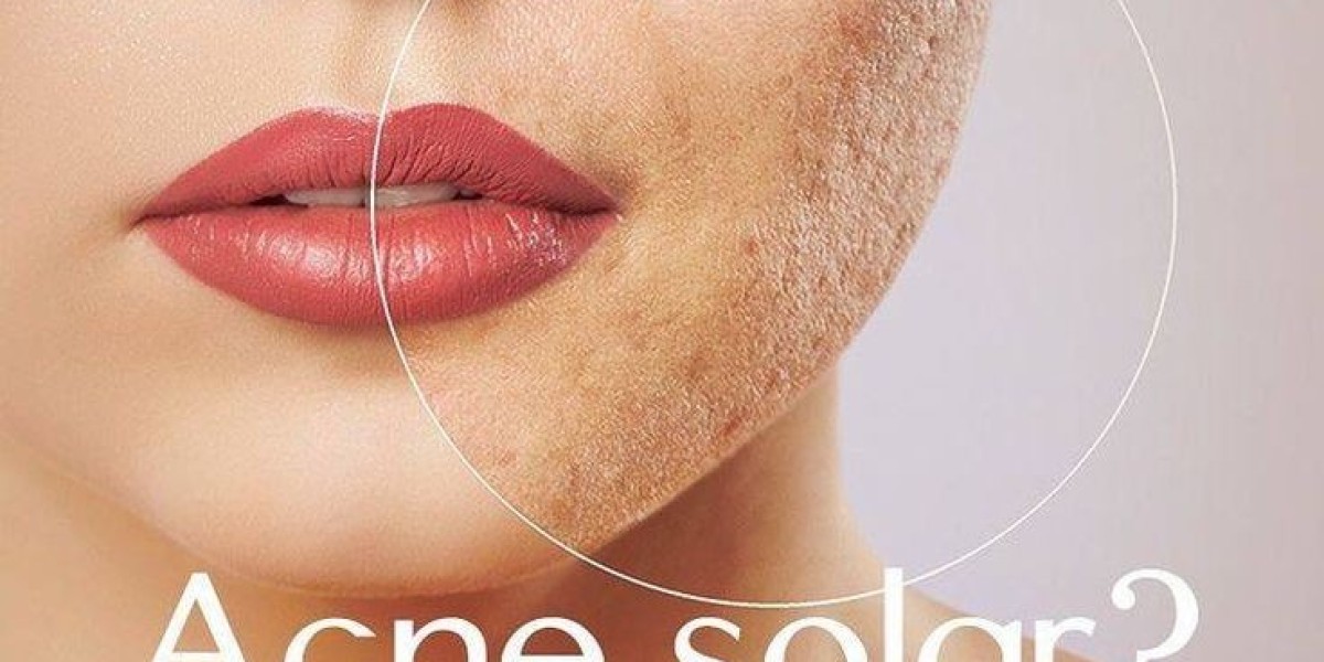 Combination Therapies for Acne Scars in Riyadh Clinics