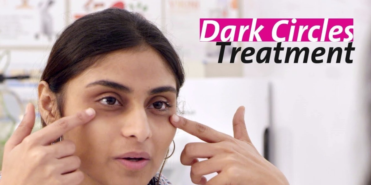Best Non-Surgical Treatments for Dark Circles in Riyadh