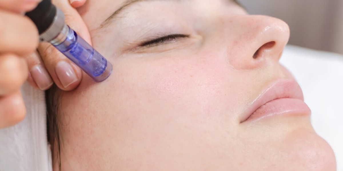 Mesotherapy in Dubai: How Much Should You Expect to Pay?
