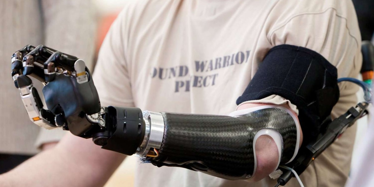 Artificial Limbs Market: The Surge in Demand for Smart and Customized Prosthetics