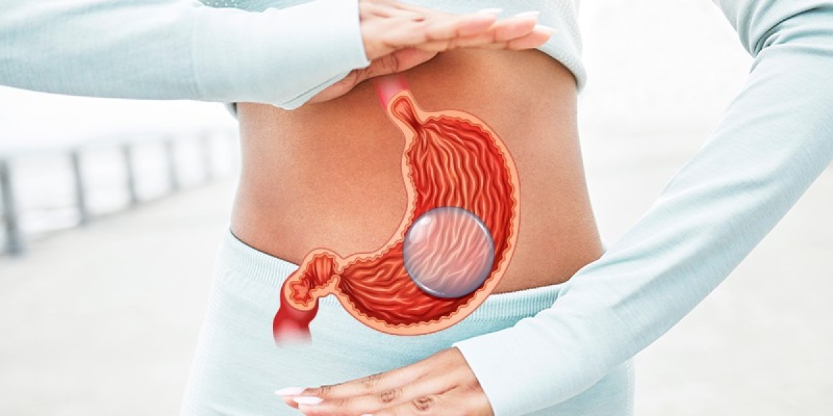 Transform Your Health: Gastric Sleeve Surgery in Riyadh