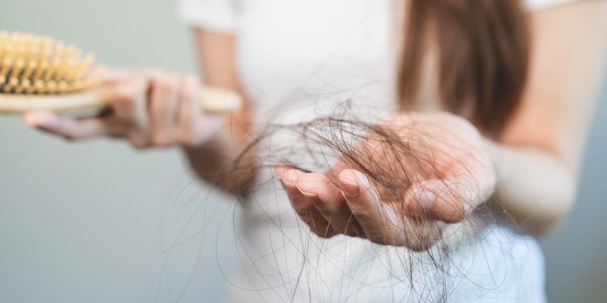 Top Treatment Options for Hair Loss: A Comprehensive Guide