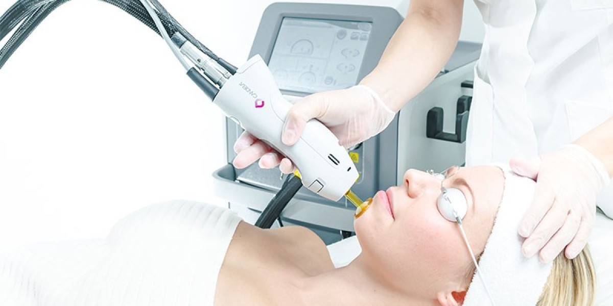 What to Expect from Electrolysis Laser Hair Removal in Dubai