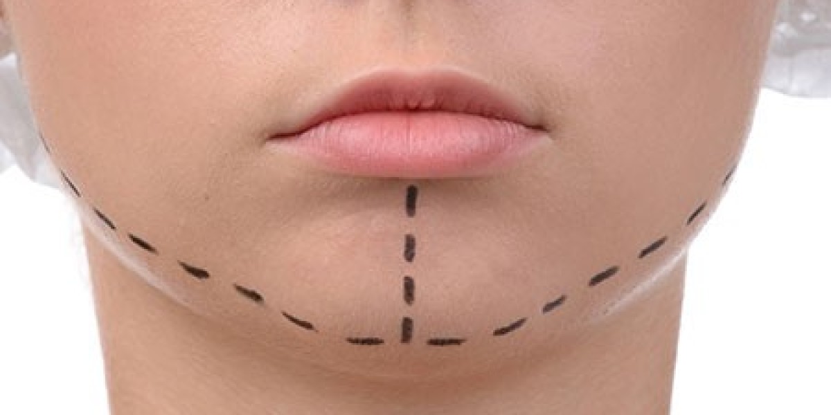 Why More People Are Choosing Jaw Contouring in Riyadh