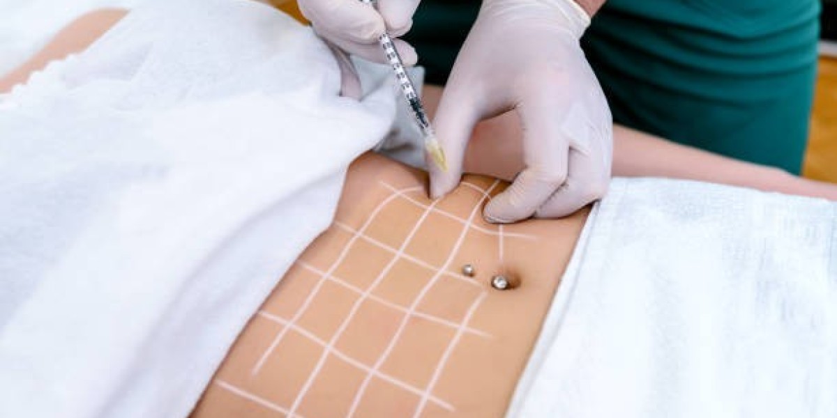 دليل الاستعداد لعملية شفط الدهون في الرياض