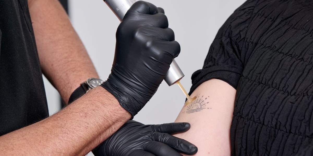 Beyond Removal: The Impact of Tattoos on Identity in Dubai
