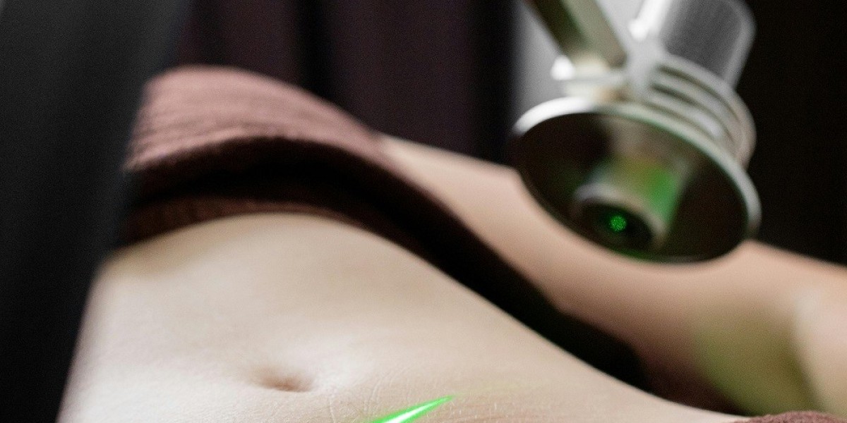 Is Fat Transfer Worth the Cost in Islamabad? A Price Evaluation
