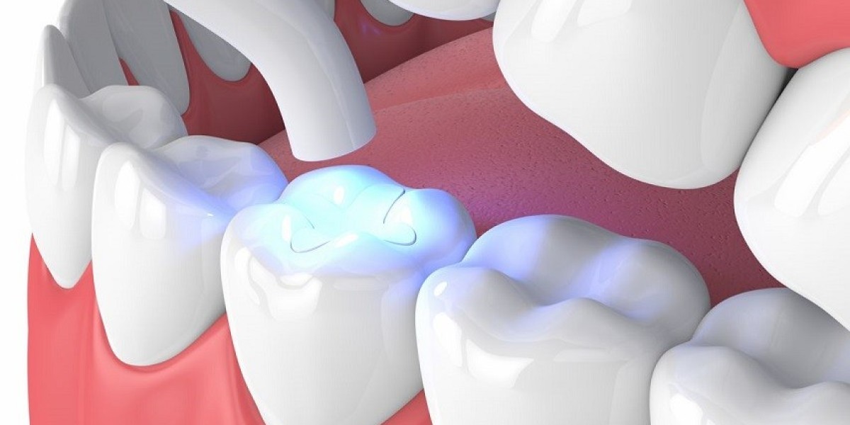 Can You Talk After a Filling?